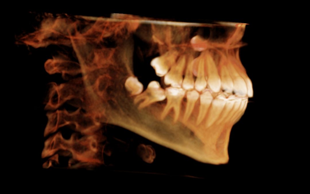 radiología boca