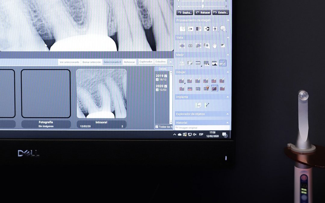 incrustaciones dentales en pantalla